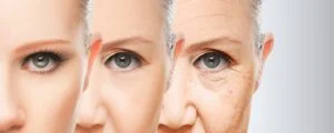 Bio-needling Facial Farmington CT